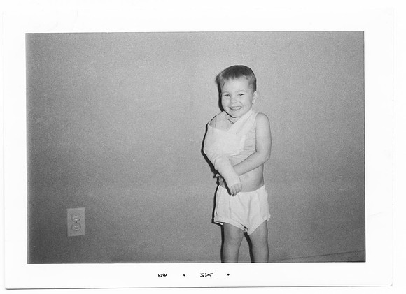 Paul broken arm (1 of 1)